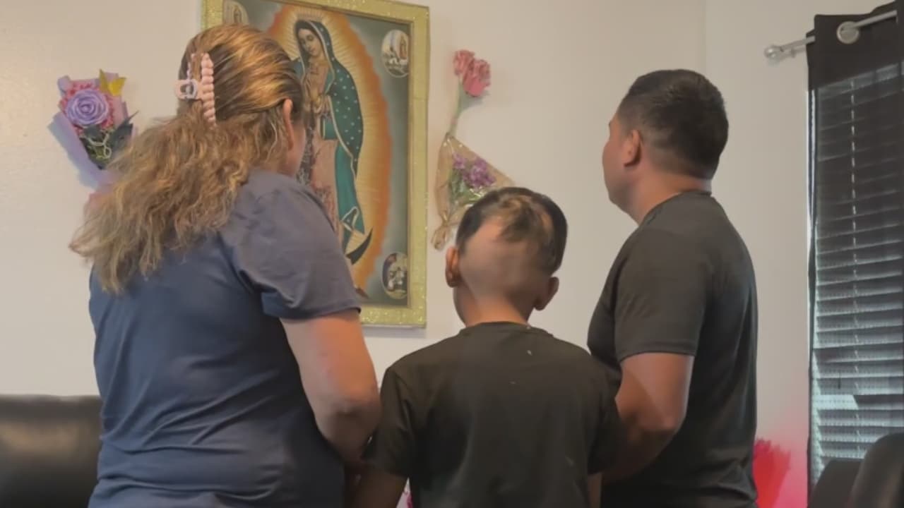 Niña perdió su cabello por supuesto acoso; fue diagnosticada con ansiedad debido a las deportaciones