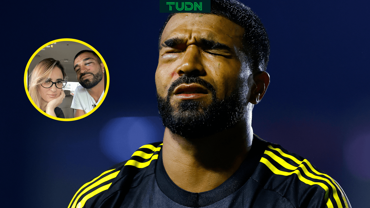 Así quedó la cara del 'Búfalo' Aguirre tras fuerte golpe en San Luis