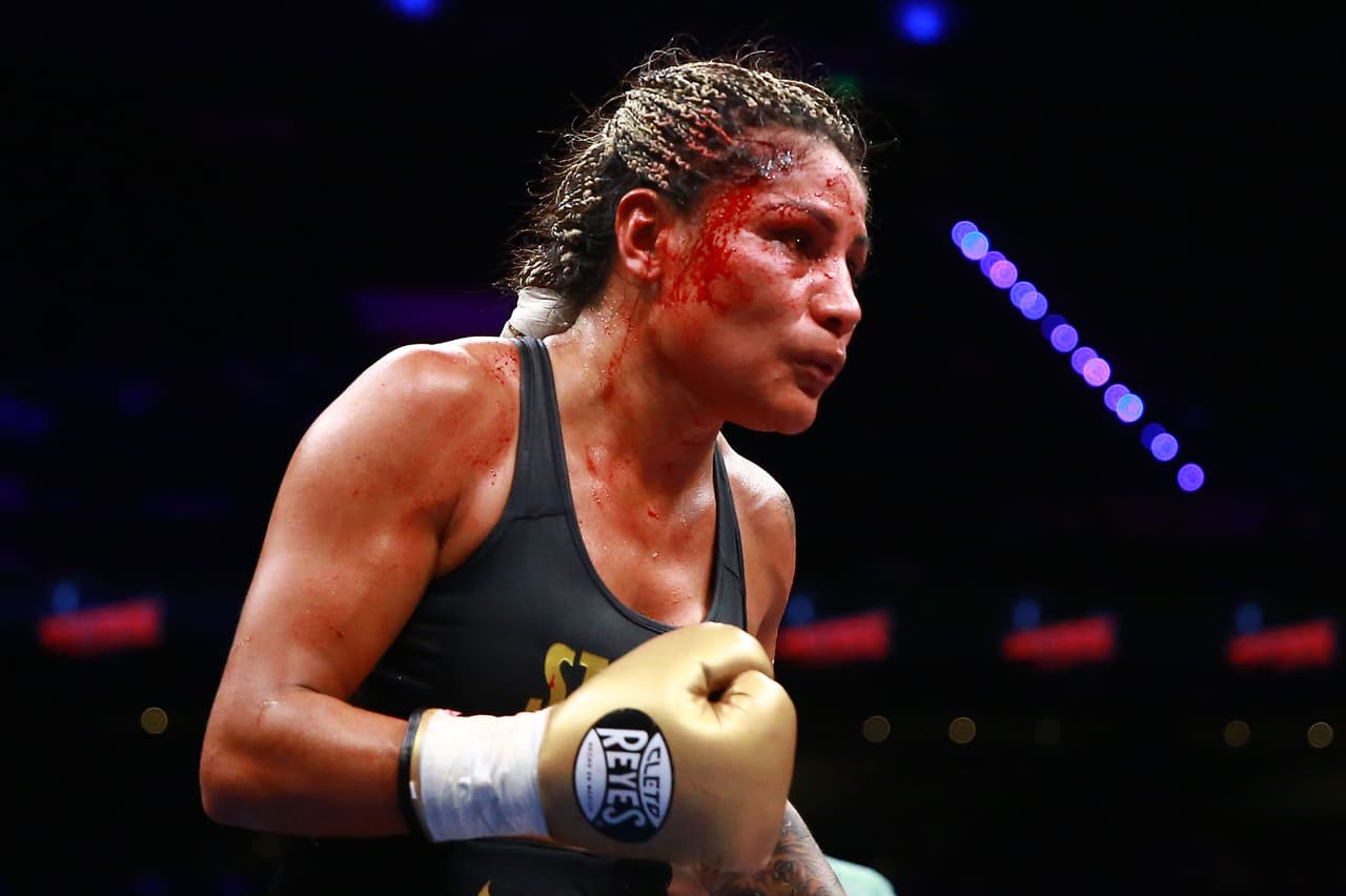Ciudad de México, 11 de agosto de 2018. Mariana Juarez , durante la función de Boxeo celebrado en la Nueva Arena Ciudad de México. Foto: Imago7/Eloisa Sanchez