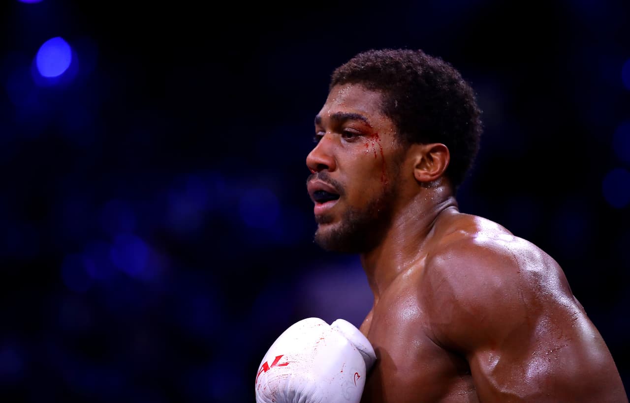 Anthony Joshua y su letal izquierda.
