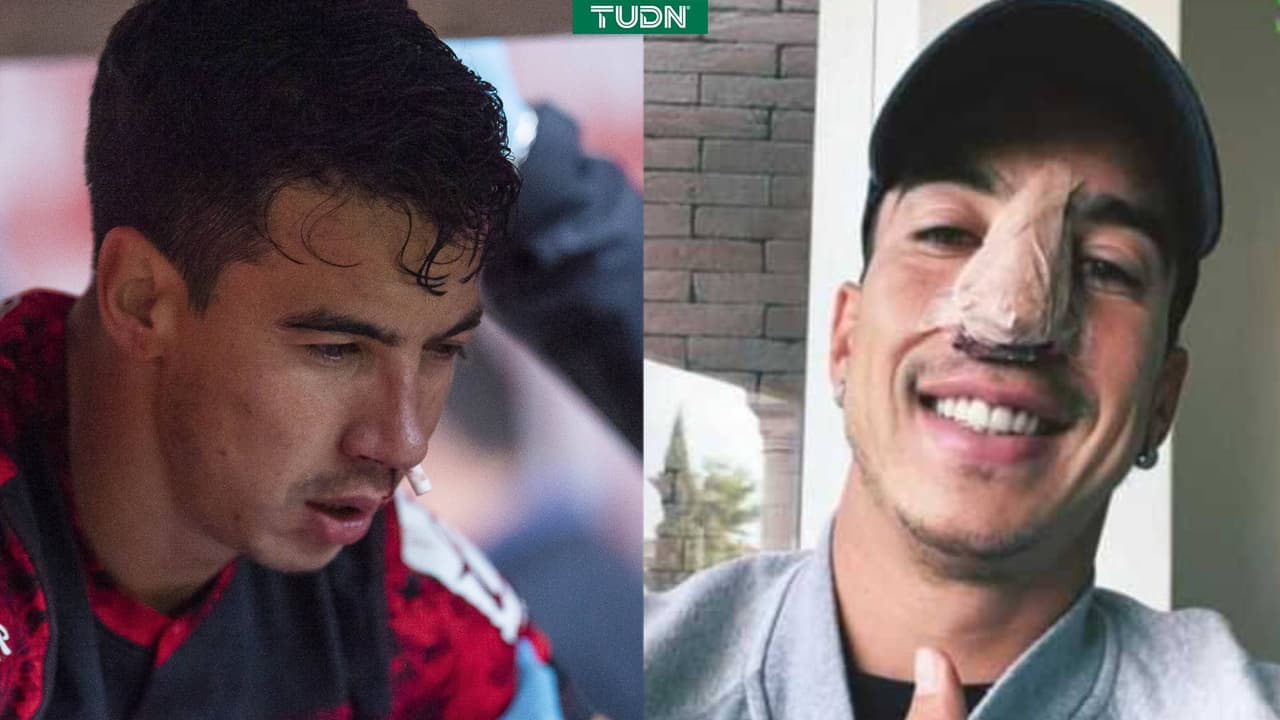 Diego Rigonato se pierde la liguilla por fractura en la nariz