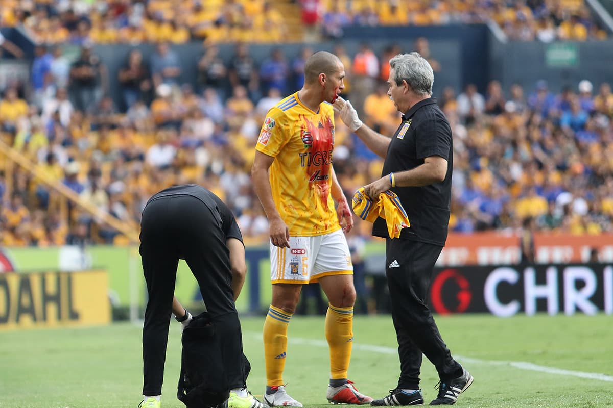 El lateral de Tigres Jorge Torres Nilo (centro) recibe atención médica luego de un codazo del argentino Enrique Triverio del Toluca (fuera de la foto) en el primer tiempo.