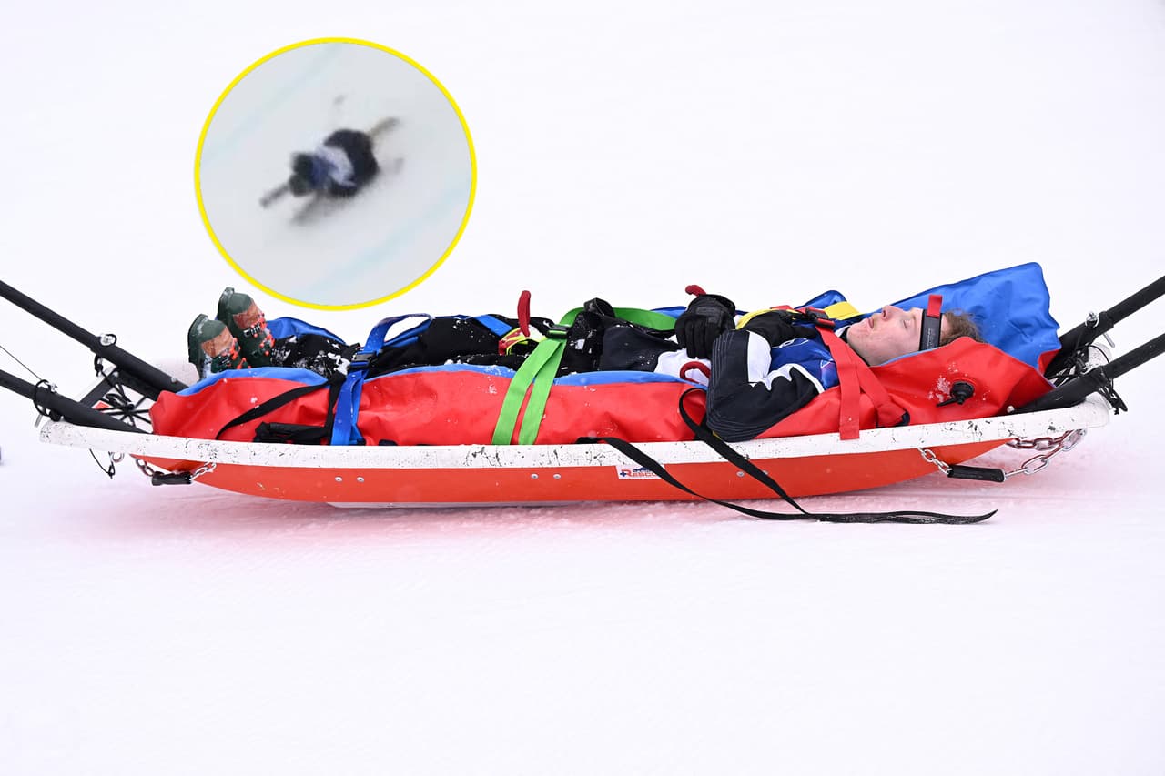 ¡Dramática escena! El campeón mundial de halfpipe, Finley Melville Ives, tuvo una fea caída