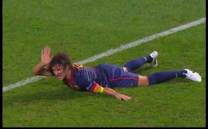 Carles Puyol sufrió una escalofriante lesión tras una luxación en el codo izquierdo.