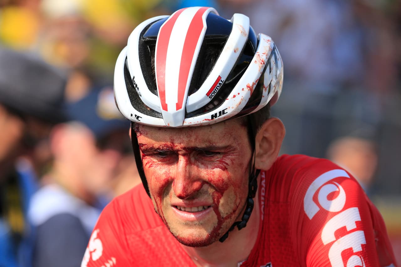 La rudeza del Tour. El pedalista belga Tiesj Benoot cruza la línea de llegada con sangre corriendo por su rostro, luego de protagonizar un choque en esta disputada cuarta etapa.