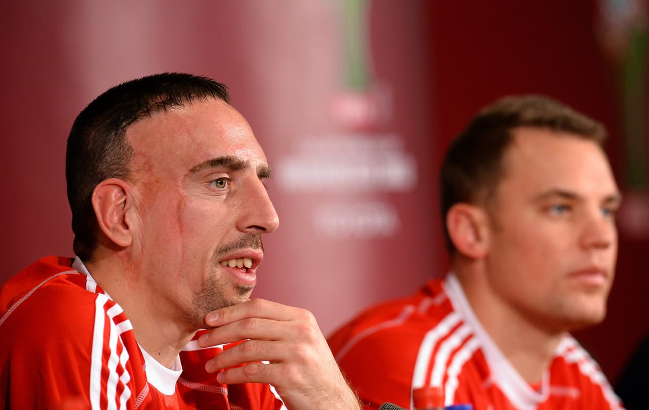 El fracés Franck Ribery tiene una herida en la derecha de su rostro sufrida desde pequeño, la cual él mismo asegura forjó en gran parte su responsabilidad. A ello se le une una sonrisa algo dispareja.