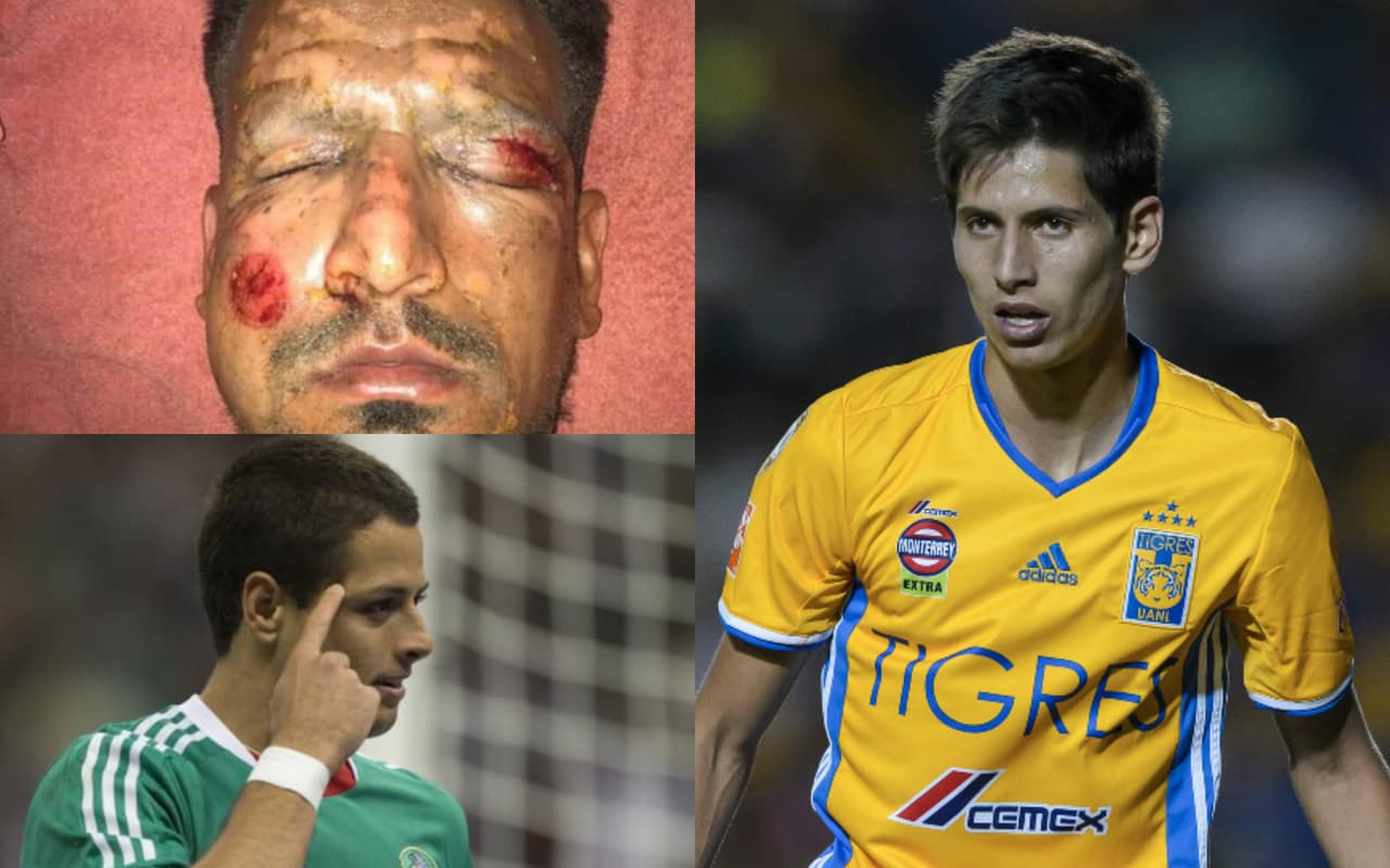 Los futbolistas son profesionales que cuidan de sus carreras, pero que en ocasiones sufren situaciones impensadas no solo para un deportista sino para cualquier persona. Algunos casos memorables.