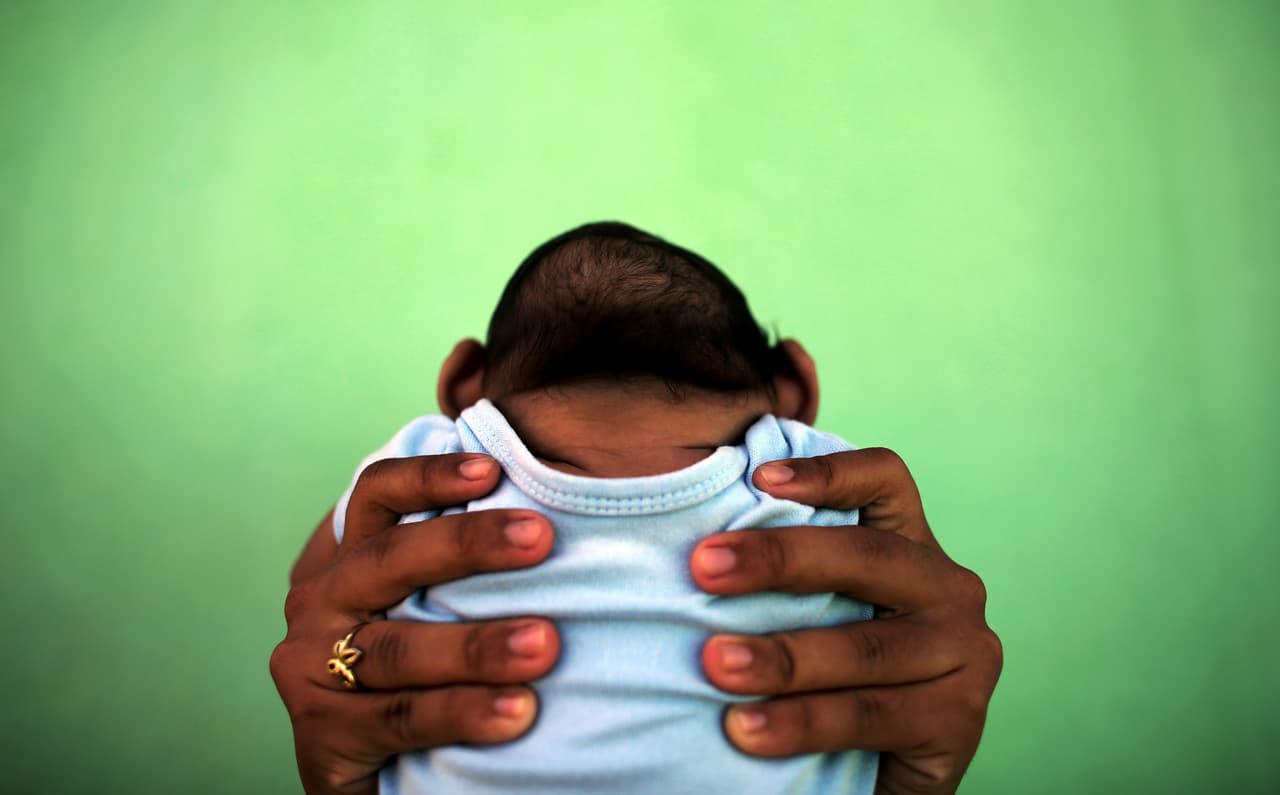 <b>El virus global</b>. Un niño de 4 meses nacido con microcefalia como consecuencia del virus del Zika que padeció su madre durante el embarazo. Recife, Brasil. 11 de febrero de 2016.