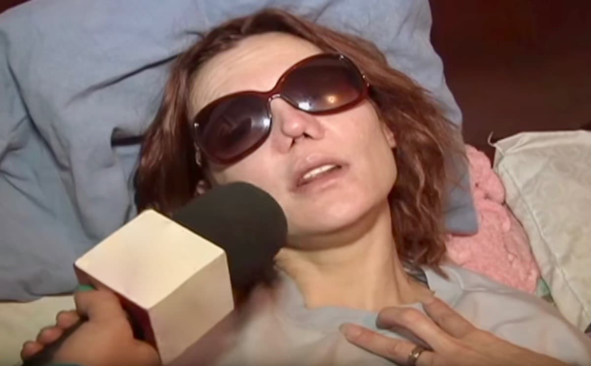 La modelo mexicana sufrió una infección que le destrozó la nariz y nunca pudo volver a lucir igual; además, también tuvo problemas con su irresponsable consumo de alcohol, lo que le costó la patria potestad de sus hijas gemelas.