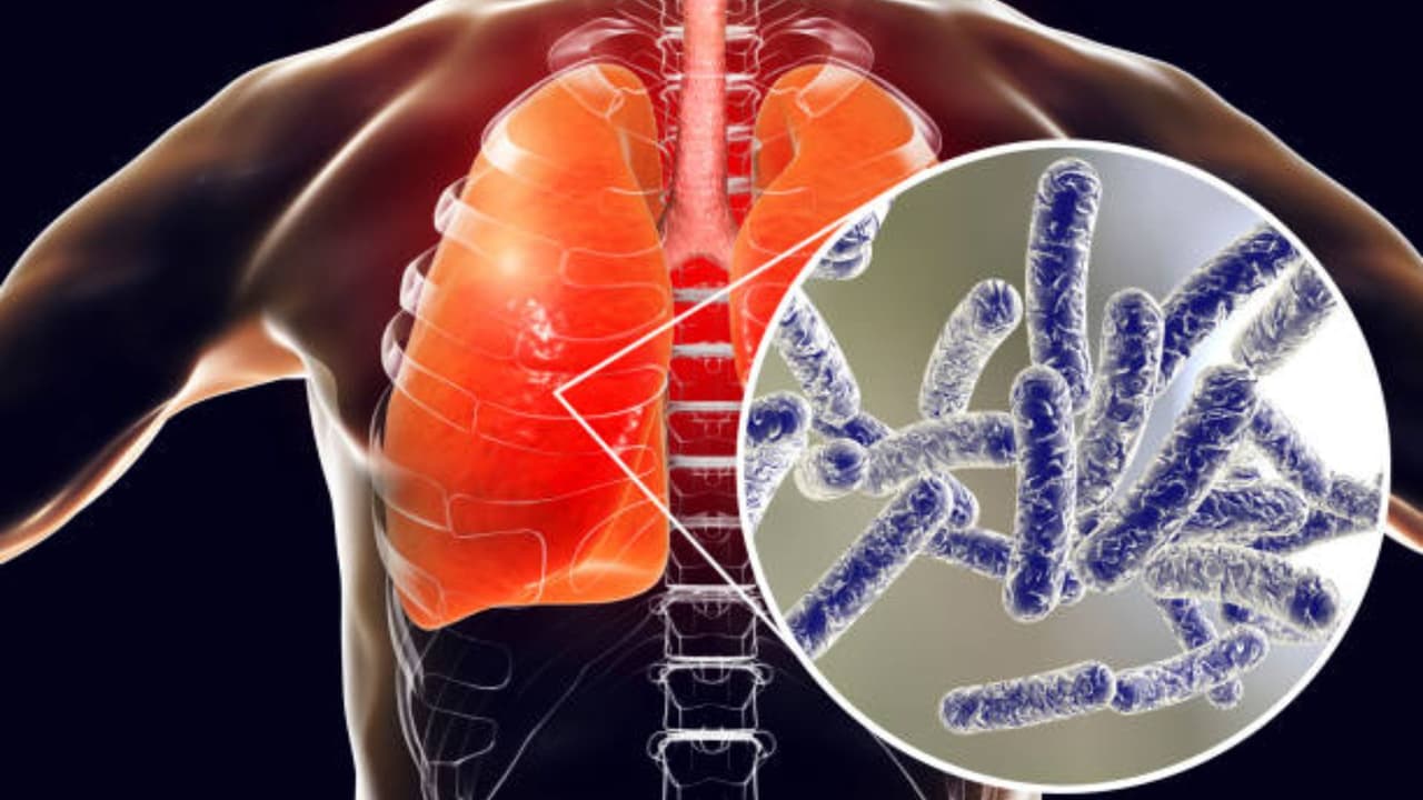 Detectan 14 casos de enfermedad del legionario asociados a un gimnasio de Florida Central