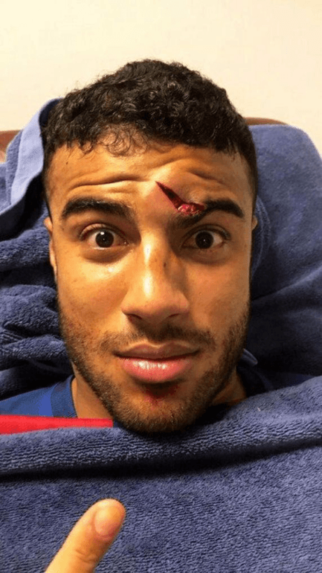 Rafinha chocó con Marc Andre ter Stegen en un partido con el Barcelona dejándole una marca para toda la vida en su frente.