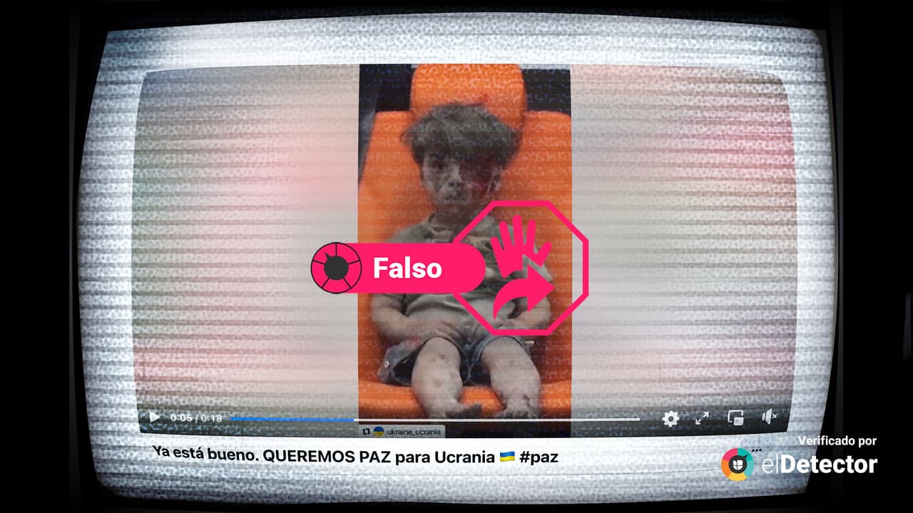 Video de un niño herido en Siria en 2016 vuelve a circular como si fuera de la guerra en Ucrania 