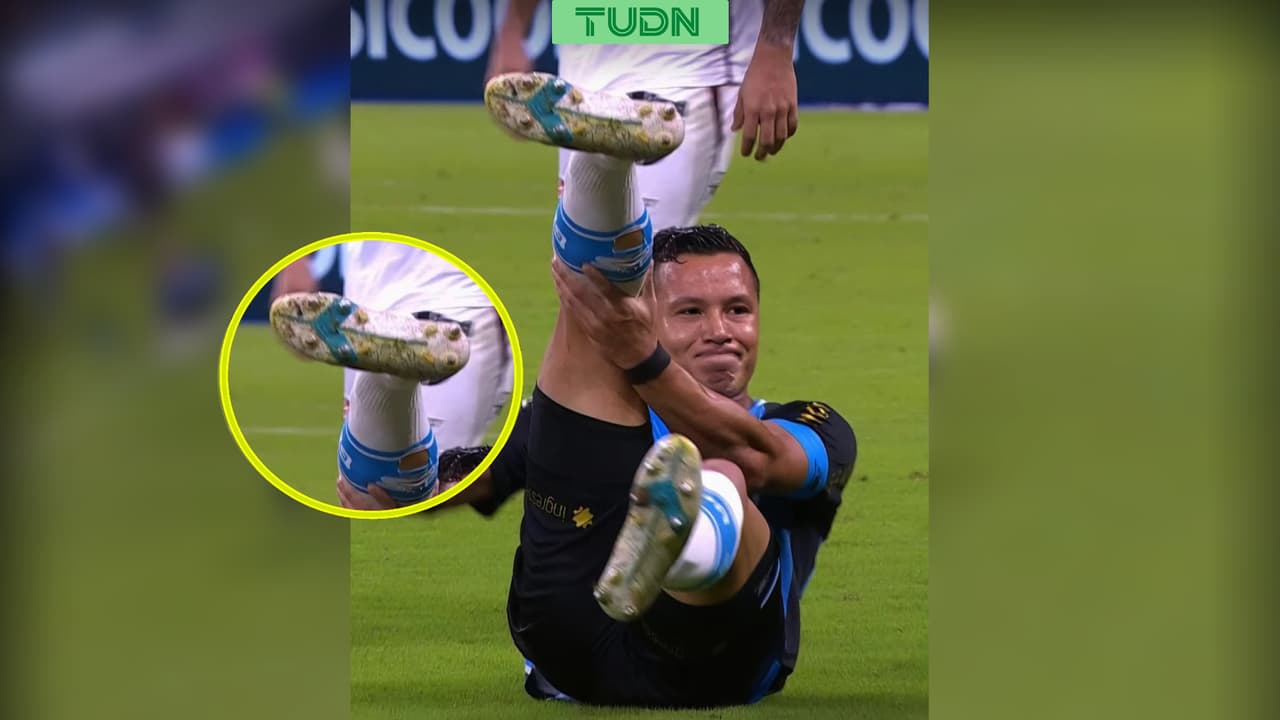 Espeluznante fractura de jugador del Gremio en el Brasileirao