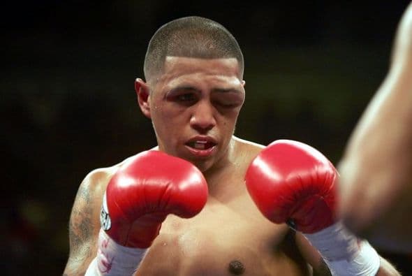 Fernando 'Feroz' Vargas y su 'tercer' ojo (Foto: Twitter).