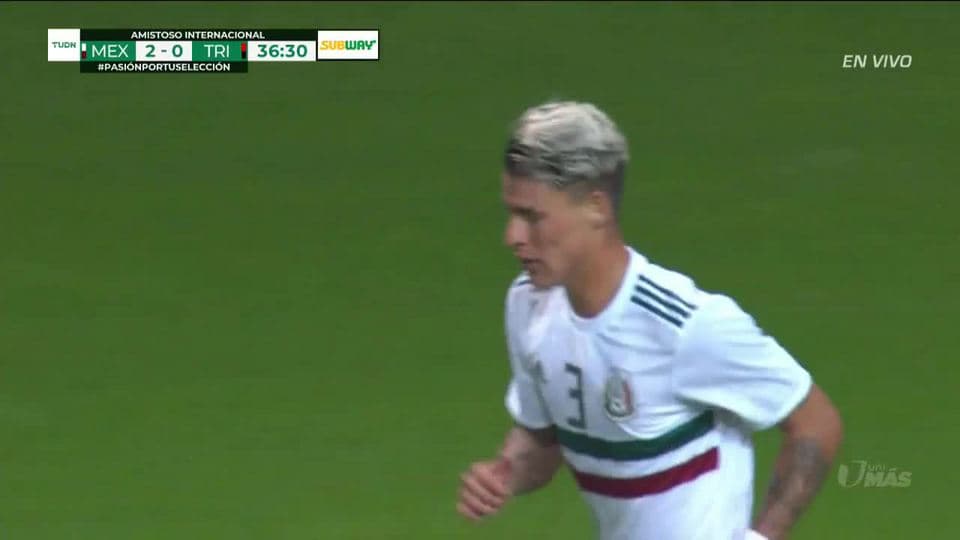 Tiro desviado de Cristian Calderón