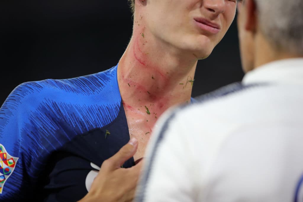 Lo peor es que esa agresión ni siquiera fue sancionada por el árbitro italiano Daniele Orsato.