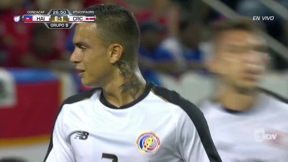 Tiro desviado de Rándall Leal