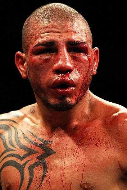 Miguel Cotto sucumbió y perdió su cetro, pero mantuvo su honor como gran pugilista, brindando un fuerte combate.