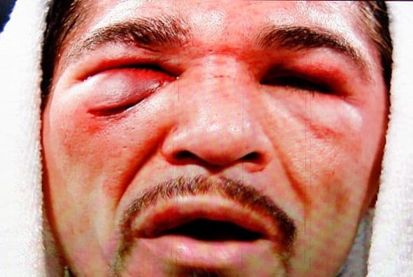 Antonio Margarito y su máscara para ir a espantar a Filipinas después de enfrentar a Manny Pacquiao.