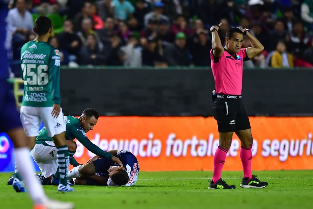 Eugenio Pizzuto tuvo un desafortunado debut en la Primera División de la Liga MX luego de sufrir una fractura en el tobillo de su pierna derecha tras una barrida donde su pie se atoró con el pasto y le propició esta grave lesión.