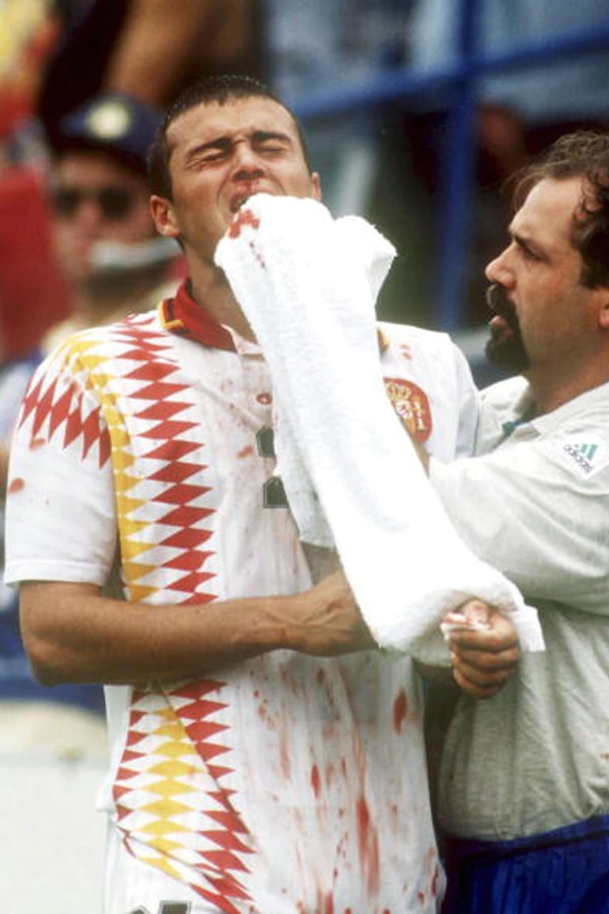 La nariz de Luis Enrique quedó fracturada y España cayó 2-1 ante Italia.