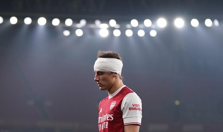 Wolverhampton se lleva la victoria 2-1 ante el Arsenal. El mexicano Raúl Jiménez salió lesionado y conmocionado tras un choque de cabezas. Los goles de los Wolves corrieron a cargo de Pedro Neto y Daniel Podence, mientras que el único tanto de los 'Gunners' fue por parte de Gabriel Dos Santos Magalhaes, en la Premier League.