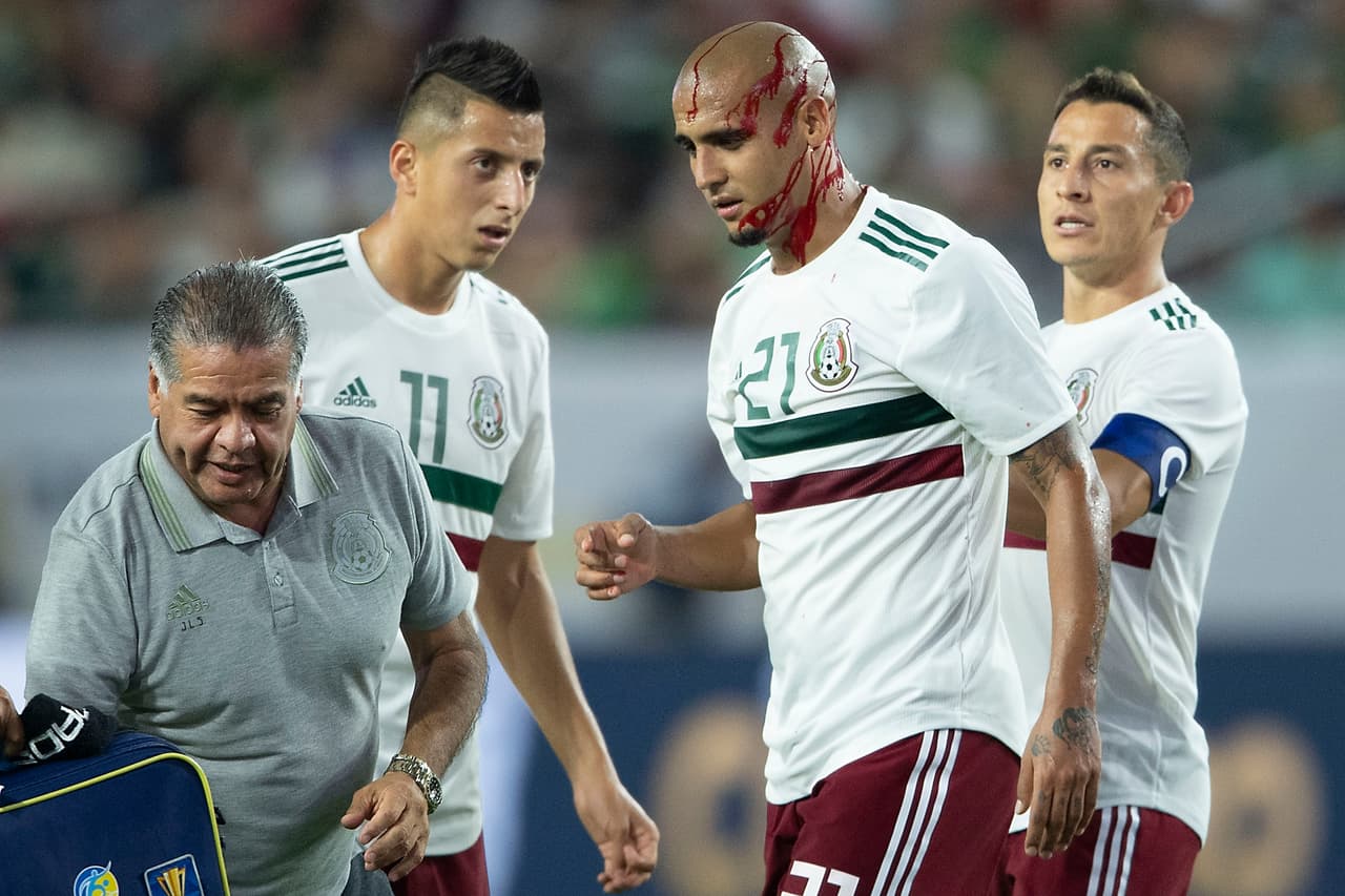 Chaka Rodríguez sale ensangrentado por recibir rodillazo en la cabeza