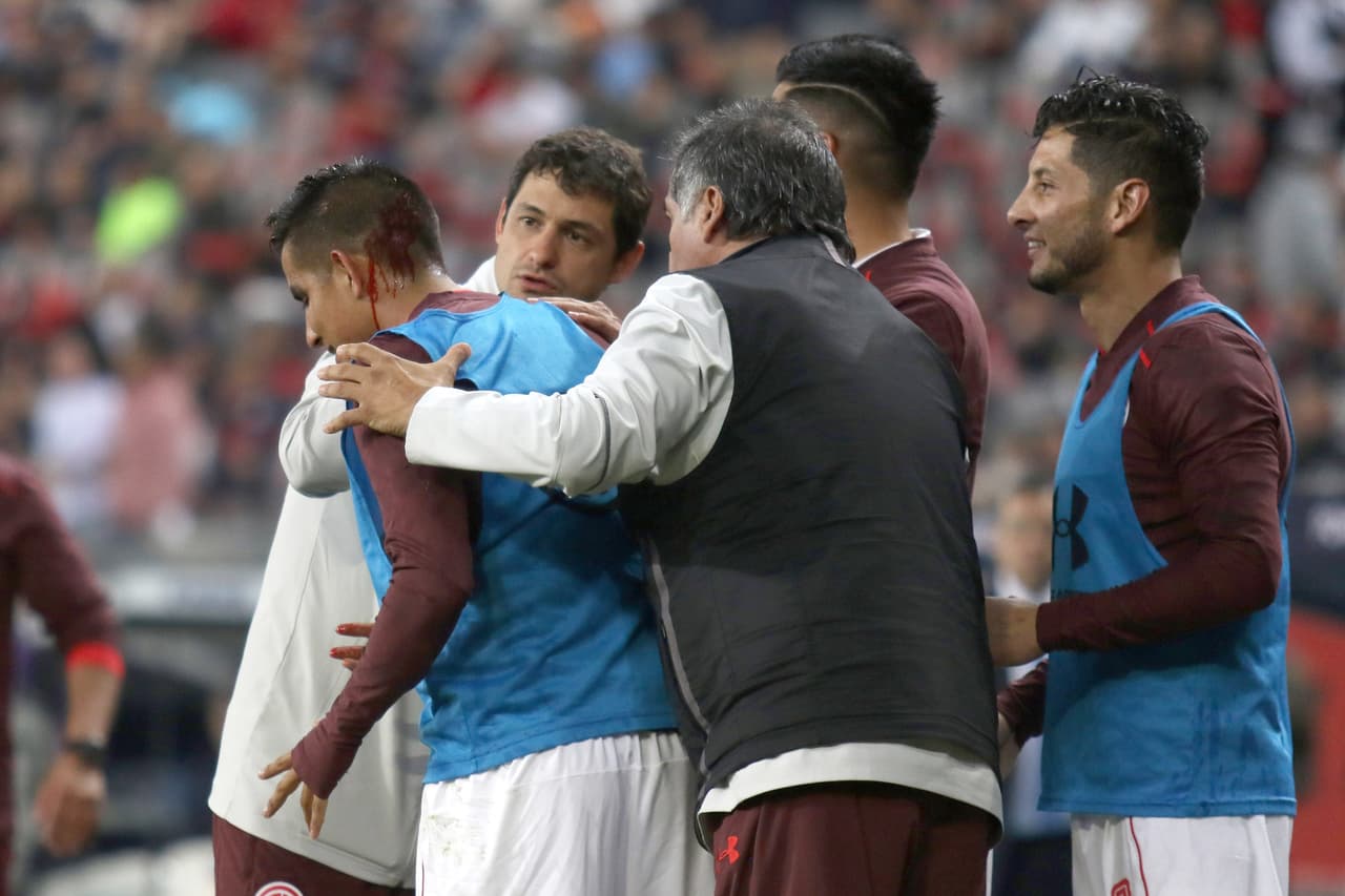 Action photo during the match between Atlas vs Toluca corresponding to the 3rd round of Liga Bancomer BBVA Closing Tournament 2018 at Jalisco Stadium, at Jalisco, Mexico. Foto de accion durante el partido Atlas vs Toluca correspondiente a la jornada 3 de la Liga Bancomer BBVA Torneo Clausura 2018, en el Estadio Jalisco. En la foto: Juan Delgadillo recibe una agresion 19/01/2018/MEXSPORT/Edgar Quintana