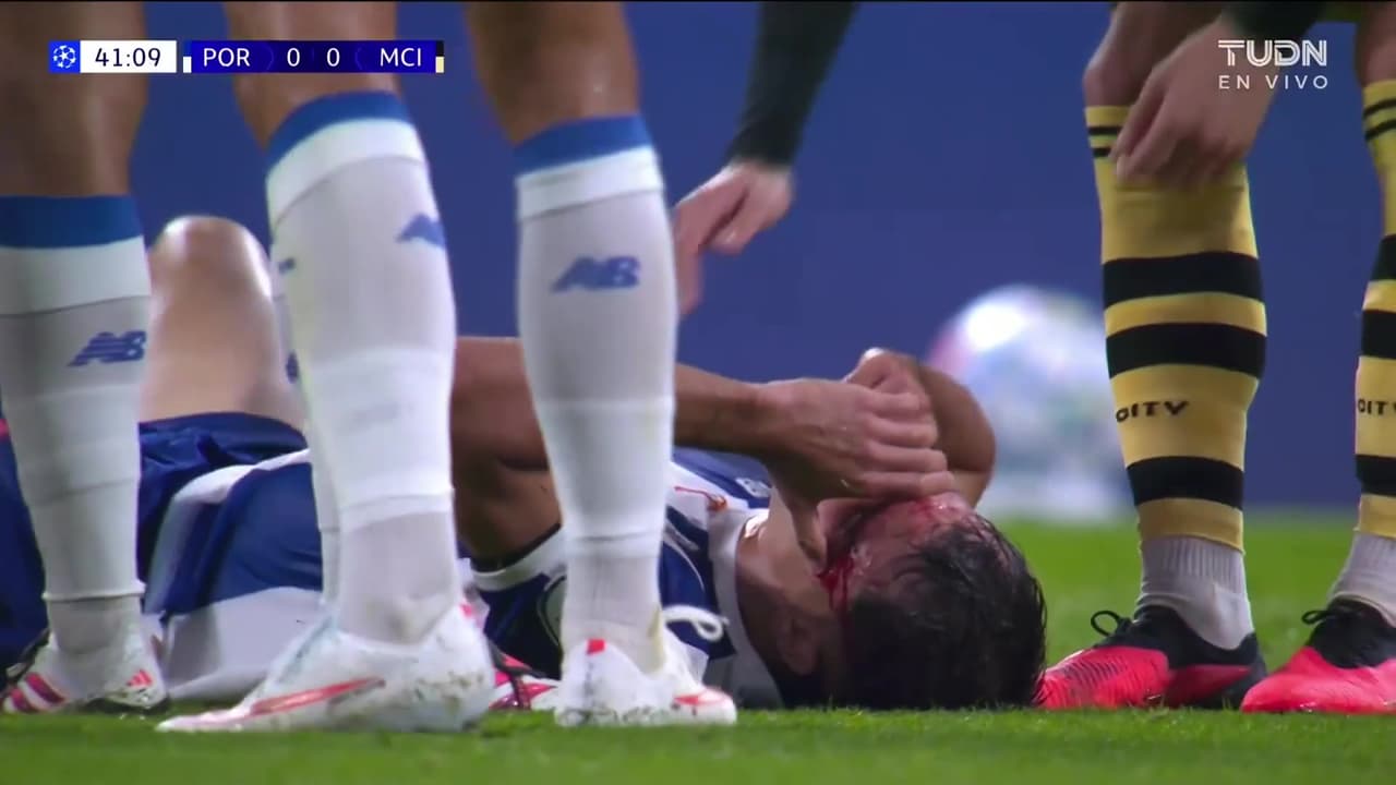 ¡Gabri Veiga terminan con el rostro sangrado por un codazo!