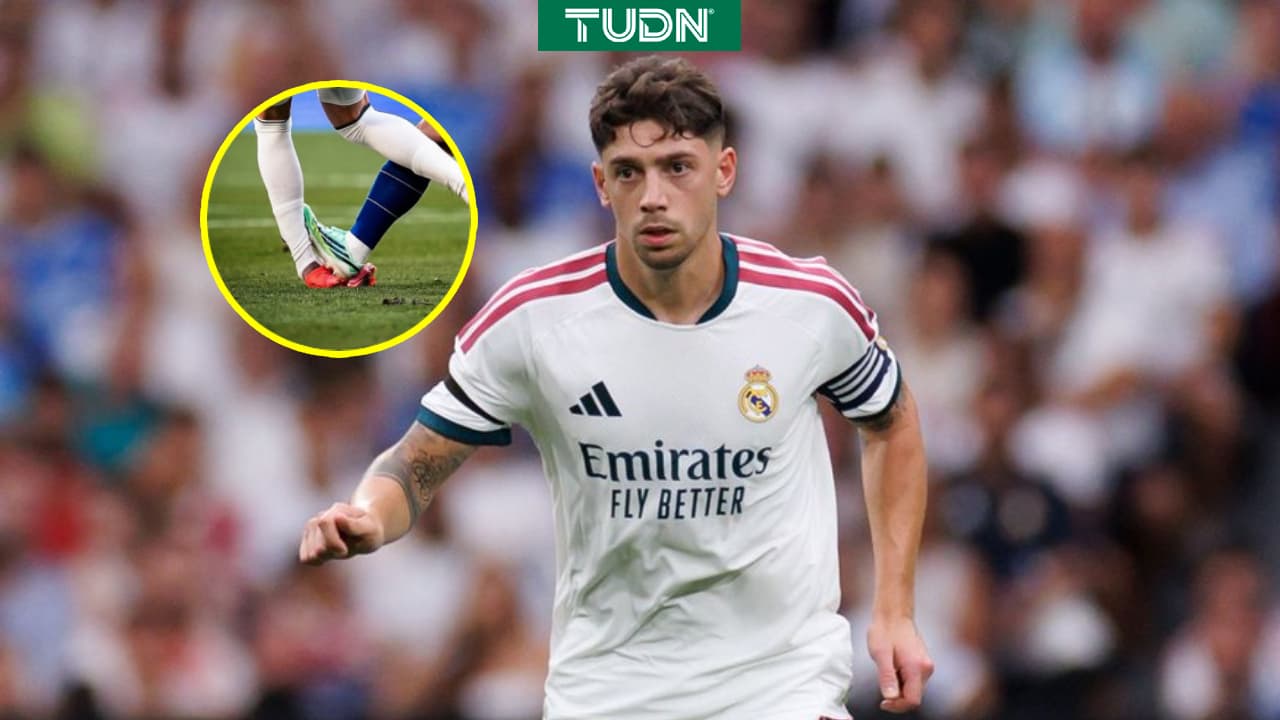 Federico Valverde será baja del Real Madrid por varias semanas tras polémica entrada