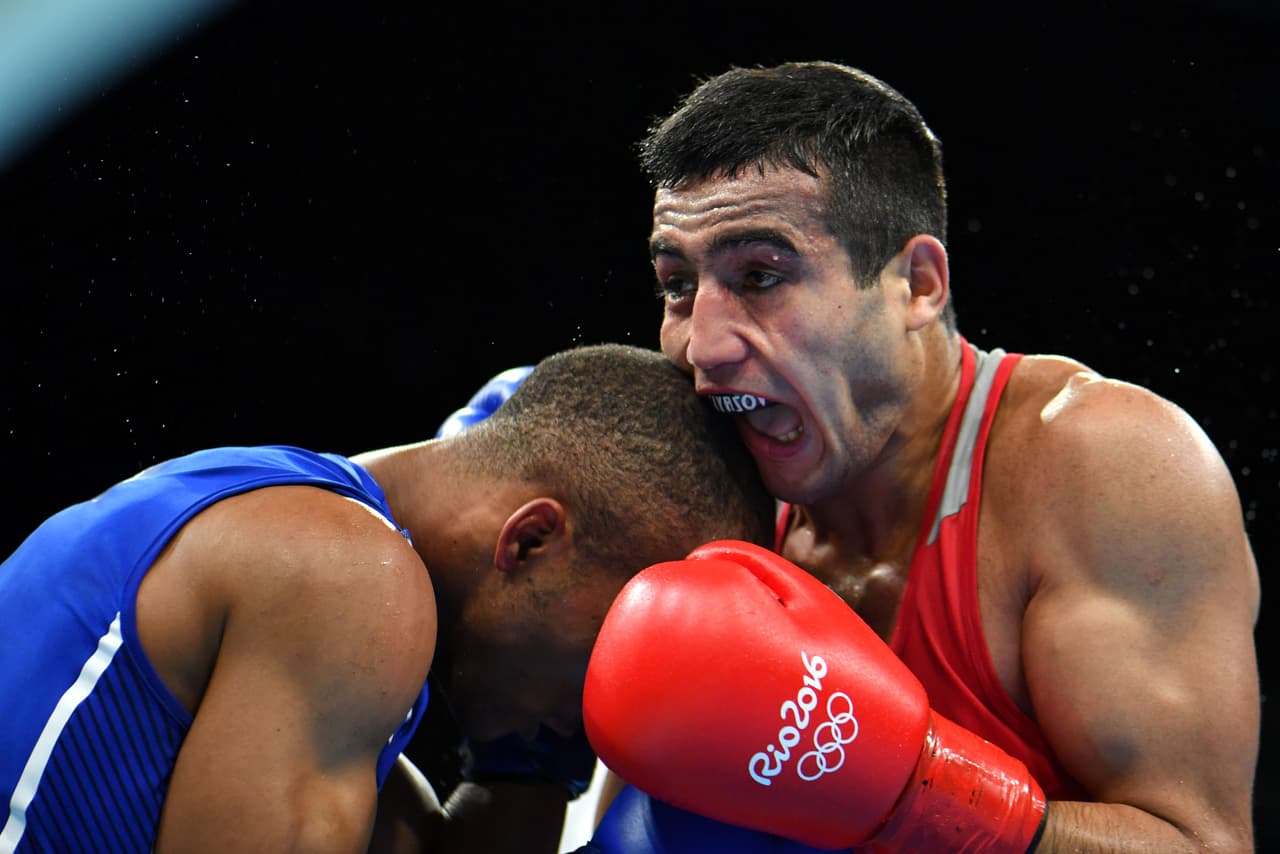 Afotunadamente existen los protectores bucales, de lo contrario se hubiera comido todo su cabello.