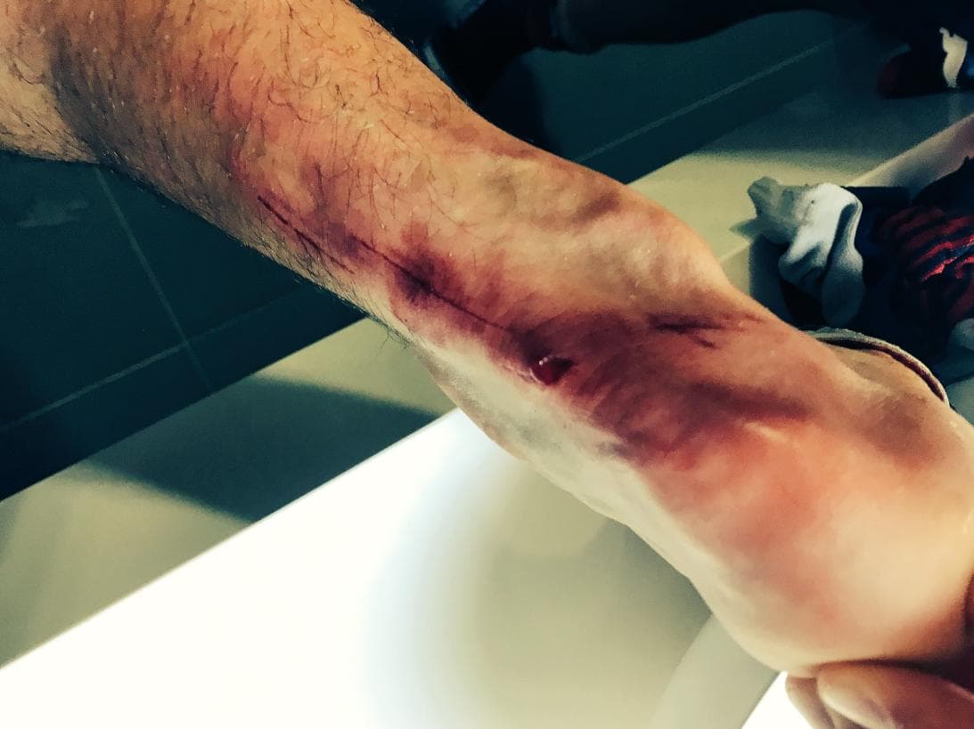 Rodolfo Pizarro exigió mayor severidad por parte de los árbitros de la Liga MX después del partido ante Santos Laguna.