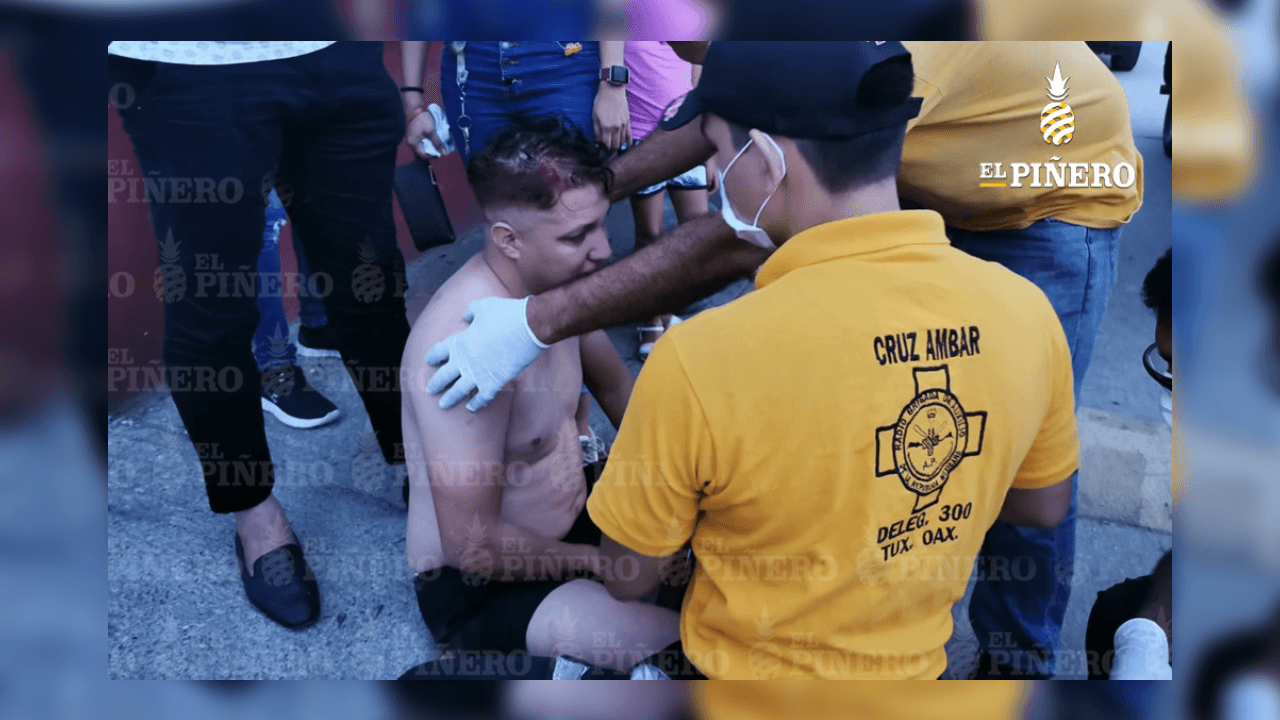 Así terminó un futbolista amateur que no hizo caso a la cuarentena y terminó lesionado, ocurrió en Oaxaca, México.