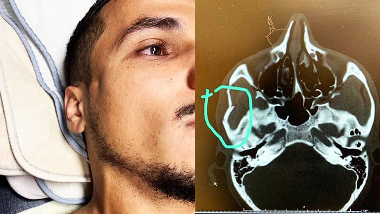 MLS abre investigación por fractura facial de Ibrahimovic a El Monir