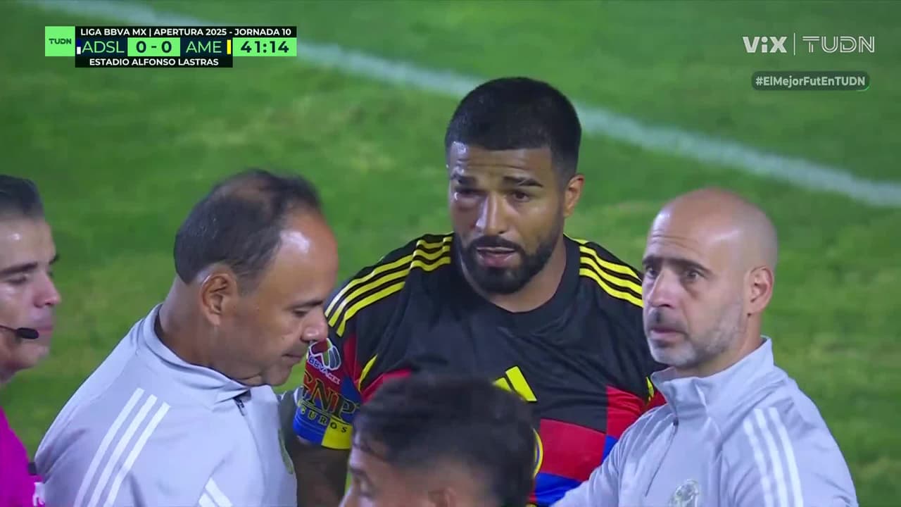 ¿Futbol o box? Búfalo termina KO en el San Luis vs. América