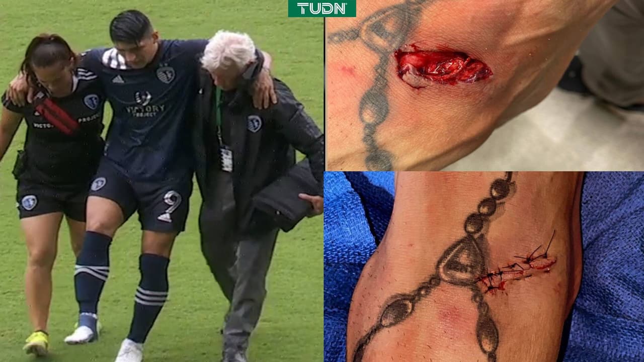 Alan Pulido muestra la impactante herida en su empeine derecho