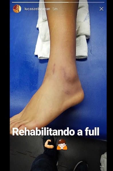 Lucas Zelarrayán, en una de sus historias de Instagram, les mostró a sus seguidores cómo se estaba recuperando tras una dura entrada que le hicieron ante Querétaro, en el Apertura 2016.