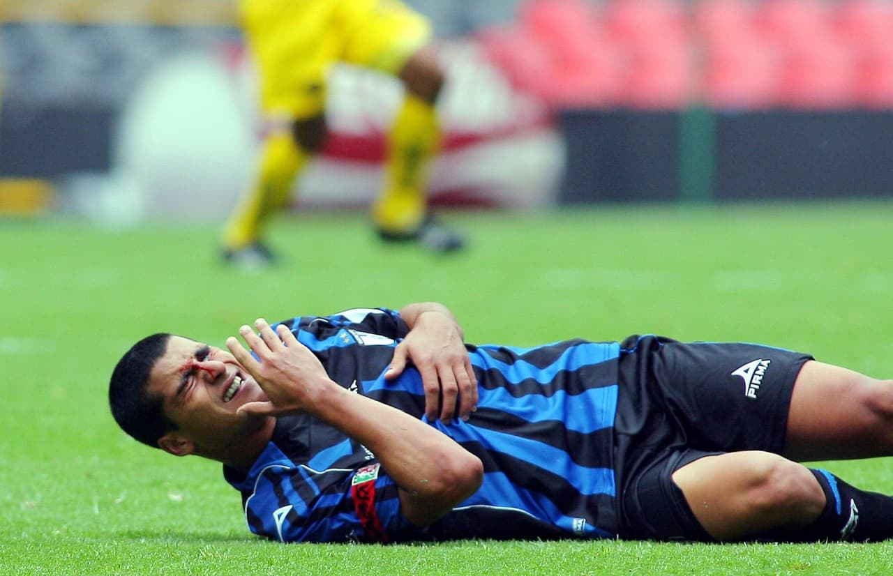 Jugando contra el Socio Águila en el Estadio Azteca, el charrúa tuvo un choque con el brasileño Izaiaz Ramos.