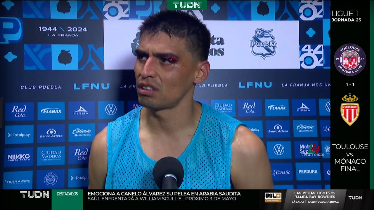 'Memote' Martínez muestra las huellas de la batalla en entrevista