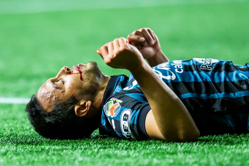 Fidel Martínez (2’) y Mauro Manotas (5’) adelantaron al cuadro fronterizo. Guzmán (7’) hizo autogol y Gallos descontaba. Gil Alcalá (31’) ‘regresó el favor’ para dejar el marcador 3-1. Tijuana y Querétaro acumulan 16 y 14 unidades, respectivamente.