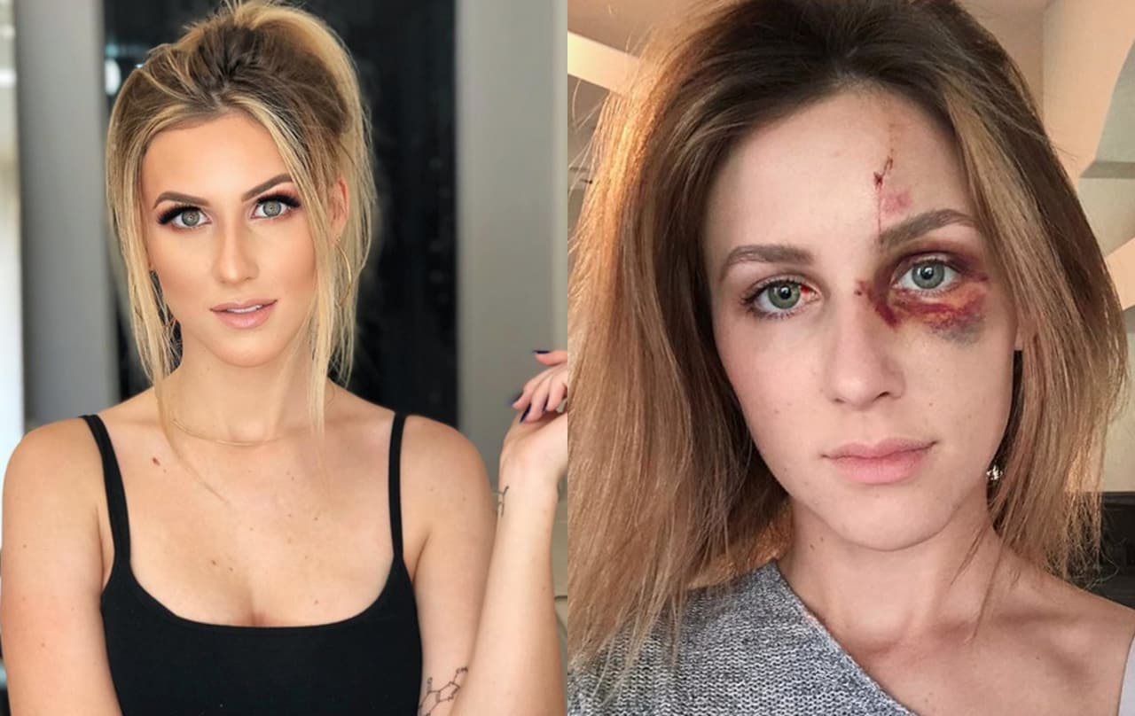 La denuncia de Melissa Gentz sobre la agresión que sufrió de su pareja, un campeón de motocross, se ha convertido en todo un referente de valentía contra los abusos de pareja.