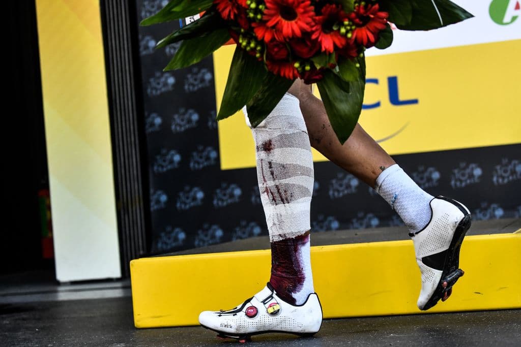 A pesar de sus heridas, el ciclista demostró valentía para acabar el recorrido en una de las tres grandes carreras del ciclismo mundial.