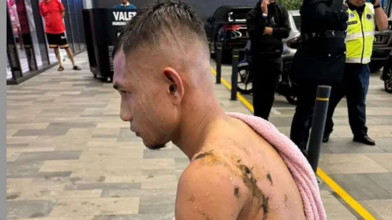 Jugador de la selección de Malasia es víctima de ataque con ácido