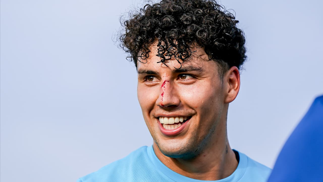 Jorge Sánchez aparece con nariz ensangrentada y roba portadas en Portugal