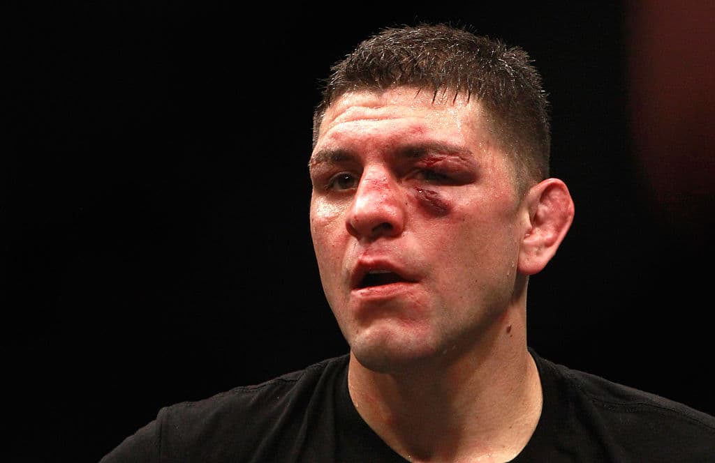 Se trata de Nick Diaz, un luchador de artes marciales mixtas de 35 años que advirtió que el representante del mexicano, Óscar de la Hoya, solo tendría que llamarlo para hacer realidad el combate.