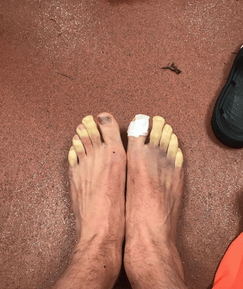 Adam Lallana (Liverpool) dejó esta fotografía impresionante en sus redes sociales, luego del partido ante Southampton. "¿Alguna recomendación para descongelar dedos?"