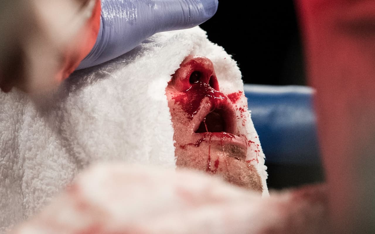 "Todos tienen un plan hasta que reciben un puñetazo en la boca", Mike Tyson.