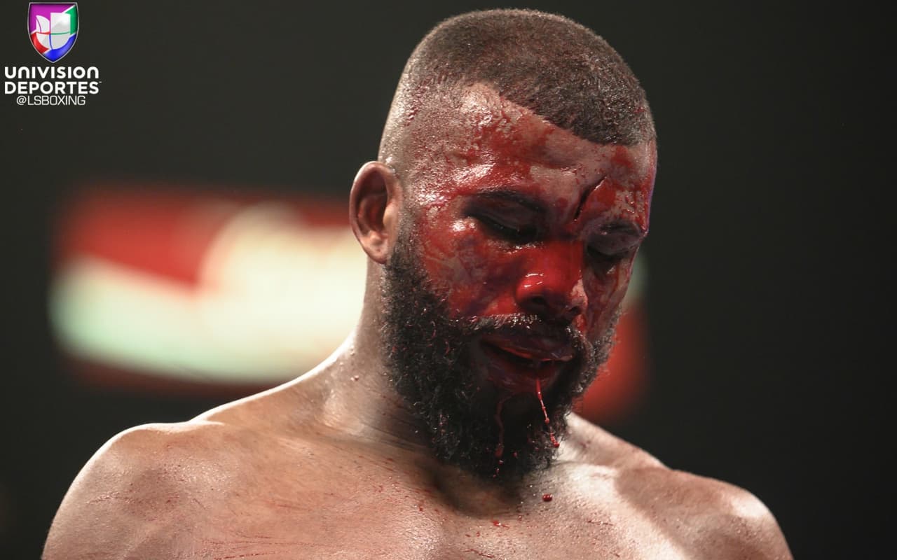 Quizás no ganó el combate Badou Jack pero se ganó el respeto y la admiración de muchos fanáticos al boxeo luego de esa gallarda exhibición de tenacidad.