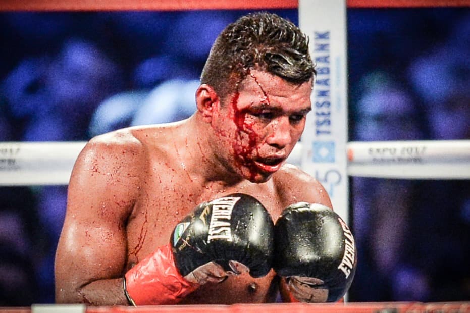 "Todos tienen un plan hasta que reciben un puñetazo en la boca", Mike Tyson.