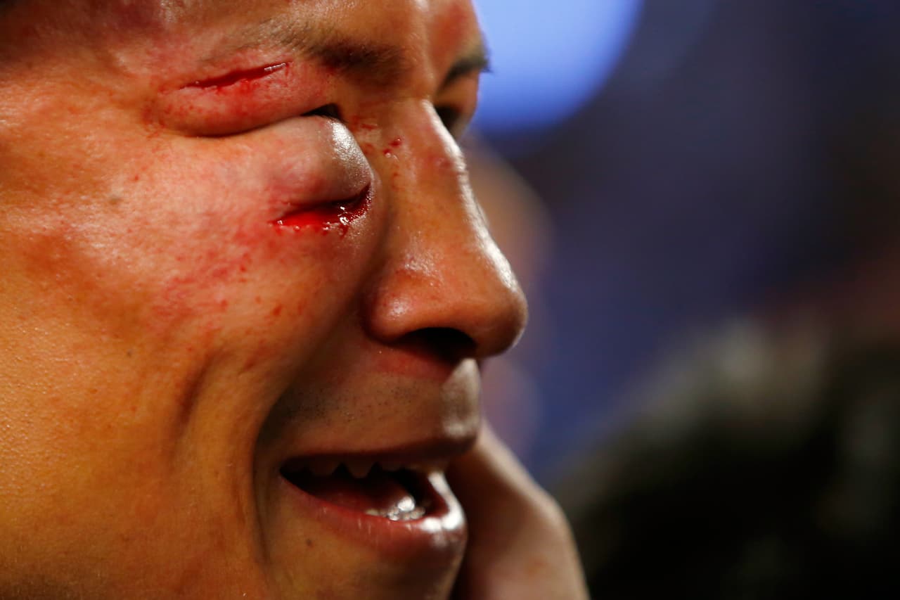 Revelaciones: Francisco ‘Bandido’ Vargas llegó como víctima a la pelea contra Takashi Miura, quien había vencido a cinco mexicano en fila, el japonés ostentaba el título superpluma CMB. El retador estuvo a punto de noquear al monarca en el primer episodio. El japonés reaccionó y en el cuarto tiró a Vargas. Finalmente, en el noveno asalto, el ‘Bandido’ tiró y después noqueo al nipón.